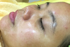 After